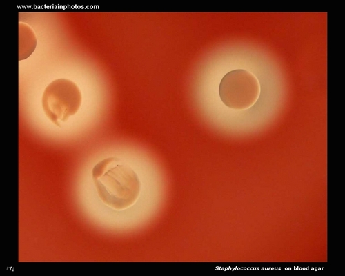 staphylococcus beta hemolysis